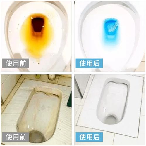 智能清洁时代 告别马桶刷，享受洁净新体验